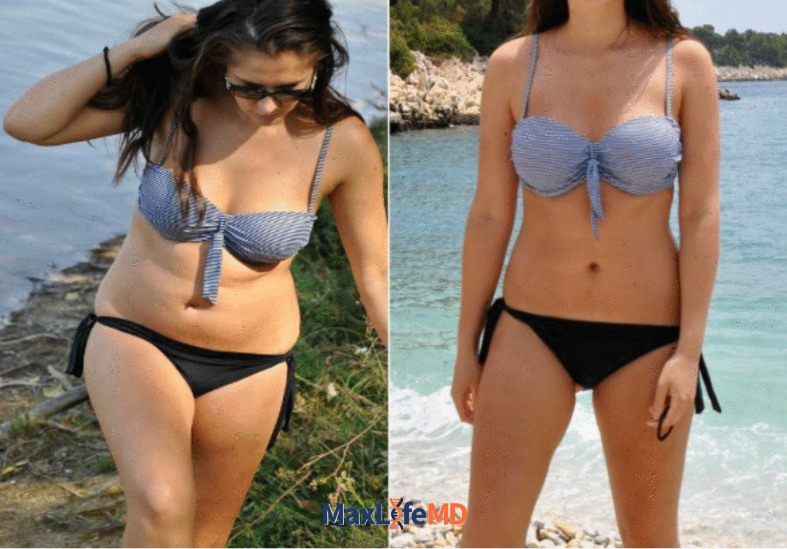 MaxLife MD Website GLP1 Tirzepatide NAD Energy Lose Weight Lose Fat Women 1